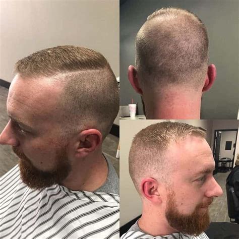 Haircut for balding crown male. Things To Know About Haircut for balding crown male. 